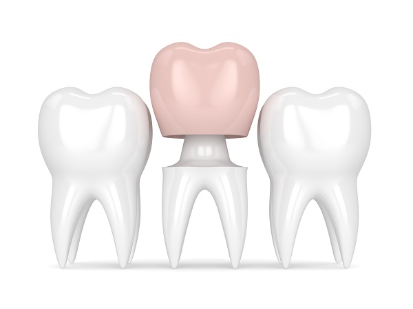 How Dental Crowns Repair and Renew Damaged Teeth